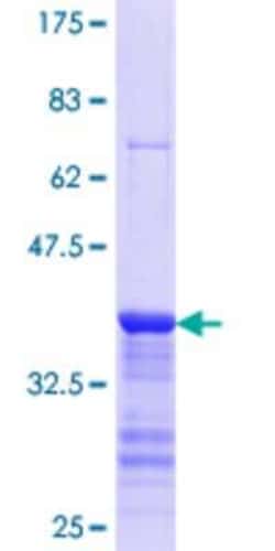 Novus Biologicals Recombinant Human SECISBP2 GST (N-Term) Protein 25 &mu;g | Buy Online | Novus Biologicals&trade; | Fisher Scientific