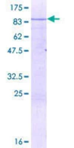 Novus Biologicals Recombinant Human NOC4L GST (N-Term) Protein 10 &mu;g | Buy Online | Novus Biologicals&trade; | Fisher Scientific
