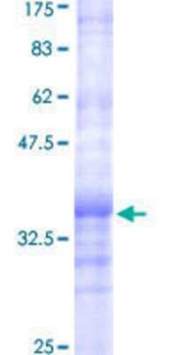 Novus Biologicals Recombinant Human ALG8 GST (N-Term) Protein 10 &mu;g | Buy Online | Novus Biologicals&trade; | Fisher Scientific