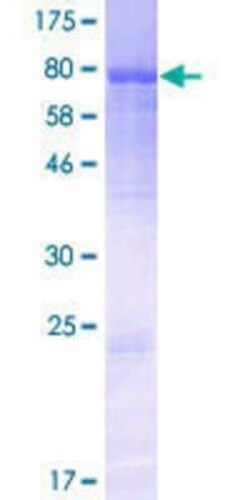 Novus Biologicals Recombinant Human KDEL GST (N-Term) Protein 25 &mu;g | Buy Online | Novus Biologicals&trade; | Fisher Scientific