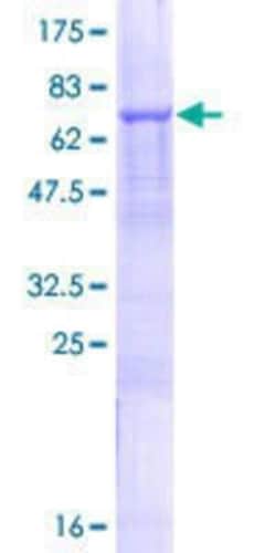 Novus Biologicals Recombinant Human SLC25A23 GST (N-Term) Protein 10 &mu;g | Buy Online | Novus Biologicals&trade; | Fisher Scientific