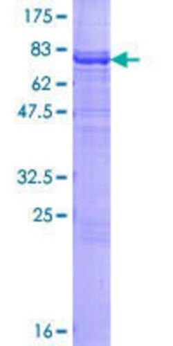 Novus Biologicals Recombinant Human CARD14 GST (N-Term) Protein 25 &mu;g | Buy Online | Novus Biologicals&trade; | Fisher Scientific