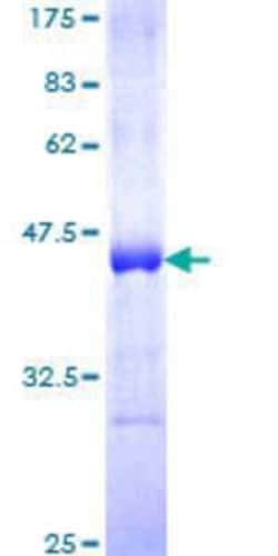 Novus Biologicals Recombinant Human CARD14 GST (N-Term) Protein 25 &mu;g | Buy Online | Novus Biologicals&trade; | Fisher Scientific