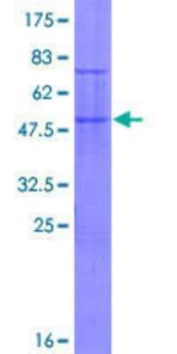 Novus Biologicals Recombinant Human TRIM48 GST (N-Term) Protein 25 &mu;g | Buy Online | Novus Biologicals&trade; | Fisher Scientific