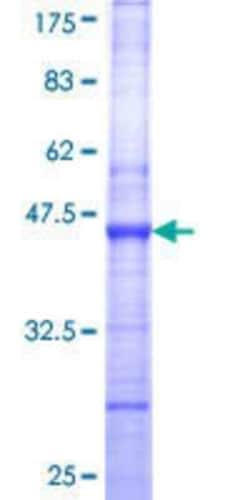 Novus Biologicals Recombinant Human Sin1/MAPKAP1 GST (N-Term) Protein 2 &mu;g | Buy Online | Novus Biologicals&trade; | Fisher Scientific
