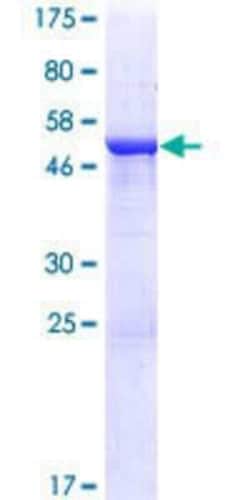 Novus Biologicals&trade;&nbsp;Recombinant Human CCDC28B GST (N-Term) Protein