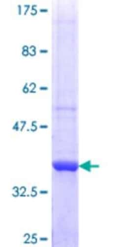 Novus Biologicals Recombinant Human MBOAT7 GST (N-Term) Protein 25 &mu;g | Buy Online | Novus Biologicals&trade; | Fisher Scientific