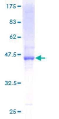 Novus Biologicals Recombinant Human MGC4172 GST (N-Term) Protein 25 &mu;g | Buy Online | Novus Biologicals&trade; | Fisher Scientific