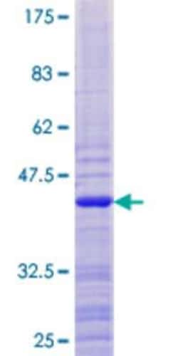 Novus Biologicals Recombinant Human ATAD4 GST (N-Term) Protein 10 &mu;g | Buy Online | Novus Biologicals&trade; | Fisher Scientific