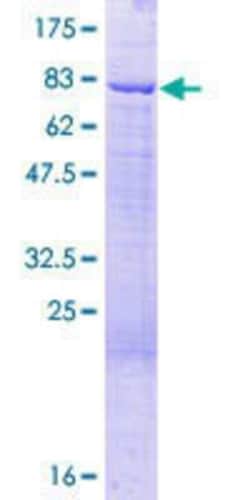 Novus Biologicals Recombinant Human RBM42 GST (N-Term) Protein 25 &mu;g | Buy Online | Novus Biologicals&trade; | Fisher Scientific