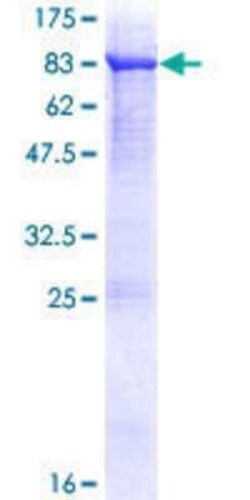 Novus Biologicals Recombinant Human FSD1 GST (N-Term) Protein 25 &mu;g | Buy Online | Novus Biologicals&trade; | Fisher Scientific