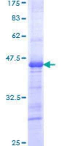 Novus Biologicals Recombinant Human IRX3 GST (N-Term) Protein 25 &mu;g | Buy Online | Novus Biologicals&trade; | Fisher Scientific
