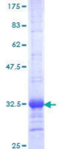 Novus Biologicals Recombinant Human IRX1 GST (N-Term) Protein 25 &mu;g | Buy Online | Novus Biologicals&trade; | Fisher Scientific