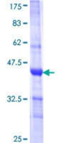 Novus Biologicals Recombinant Human WDR58 GST (N-Term) Protein 25 &mu;g | Buy Online | Novus Biologicals&trade; | Fisher Scientific