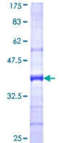 Novus Biologicals Recombinant Human DCAF10 GST (N-Term) Protein 10 &mu;g | Buy Online | Novus Biologicals&trade; | Fisher Scientific