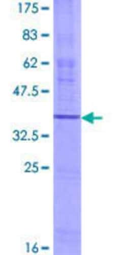Novus Biologicals Recombinant Human OR7E91P GST (N-Term) Protein 25 &mu;g | Buy Online | Novus Biologicals&trade; | Fisher Scientific