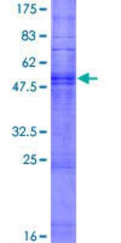 Novus Biologicals Recombinant Human OR51B4 GST (N-Term) Protein 25 &mu;g | Buy Online | Novus Biologicals&trade; | Fisher Scientific