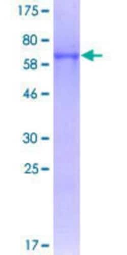 Novus Biologicals Recombinant Human NSBP1 GST (N-Term) Protein 10 &mu;g | Buy Online | Novus Biologicals&trade; | Fisher Scientific