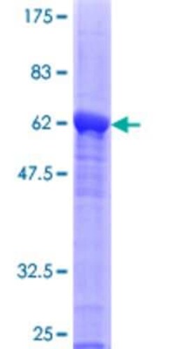 Novus Biologicals Recombinant Human Bcl G GST (N-Term) Protein 25 &mu;g | Buy Online | Novus Biologicals&trade; | Fisher Scientific