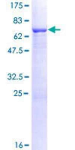 Novus Biologicals Recombinant Human LRRC2 GST (N-Term) Protein 25 &mu;g | Buy Online | Novus Biologicals&trade; | Fisher Scientific