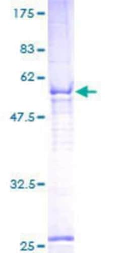 Novus Biologicals Recombinant Human MAIP1 GST (N-Term) Protein 10 &mu;g | Buy Online | Novus Biologicals&trade; | Fisher Scientific
