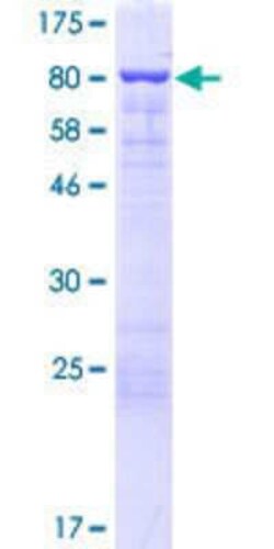 Novus Biologicals Recombinant Human EPS8L3 GST (N-Term) Protein 2 &mu;g | Buy Online | Novus Biologicals&trade; | Fisher Scientific