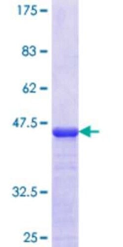 Novus Biologicals Recombinant Human GRAIL/RNF128 GST (N-Term) Protein 10 &mu;g | Buy Online | Novus Biologicals&trade; | Fisher Scientific