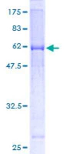 Novus Biologicals Recombinant Human MUL1 GST (N-Term) Protein 10 &mu;g | Buy Online | Novus Biologicals&trade; | Fisher Scientific