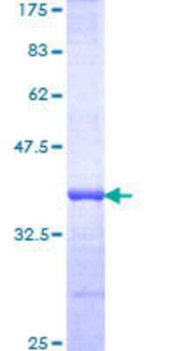 Novus Biologicals Recombinant Human RNF219 GST (N-Term) Protein 10 &mu;g | Buy Online | Novus Biologicals&trade; | Fisher Scientific