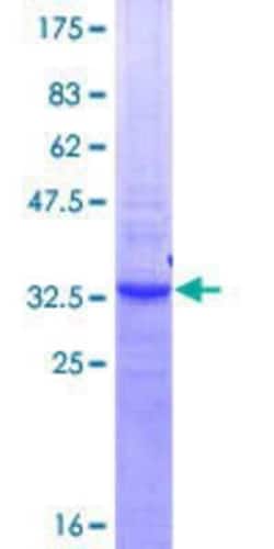 Novus Biologicals Recombinant Human LASS4 GST (N-Term) Protein 10 &mu;g | Buy Online | Novus Biologicals&trade; | Fisher Scientific