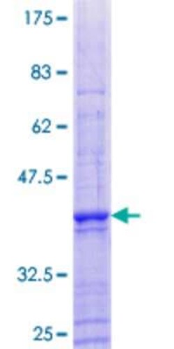 Novus Biologicals Recombinant Human CCNJL GST (N-Term) Protein 25 &mu;g | Buy Online | Novus Biologicals&trade; | Fisher Scientific