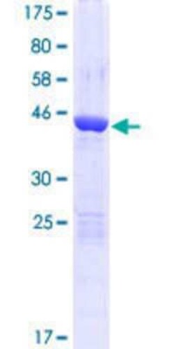 Novus Biologicals Recombinant Human ARMC7 GST (N-Term) Protein 10 &mu;g | Buy Online | Novus Biologicals&trade; | Fisher Scientific