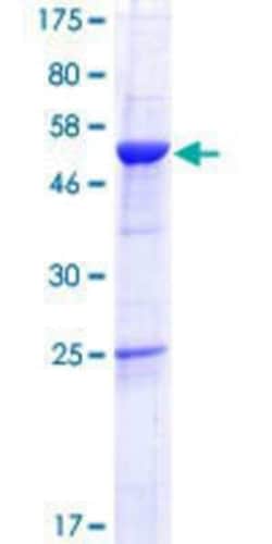 Novus Biologicals Recombinant Human ROGDI GST (N-Term) Protein 25 &mu;g | Buy Online | Novus Biologicals&trade; | Fisher Scientific