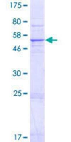 Novus Biologicals Recombinant Human SRD5A3 GST (N-Term) Protein 2 &mu;g | Buy Online | Novus Biologicals&trade; | Fisher Scientific