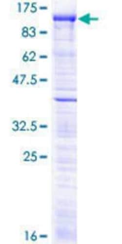 Novus Biologicals Recombinant Human MCPH1 GST (N-Term) Protein 10 &mu;g | Buy Online | Novus Biologicals&trade; | Fisher Scientific