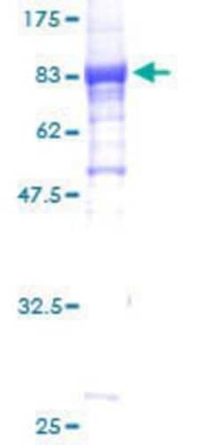 Novus Biologicals Recombinant Human HspBAP1 GST (N-Term) Protein 25 &mu;g | Buy Online | Novus Biologicals&trade; | Fisher Scientific
