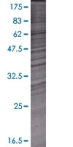 Novus Biologicals NARG2 293T Cell Transient Overexpression Lysate 0.1 mL | Buy Online | Novus Biologicals&trade; | Fisher Scientific