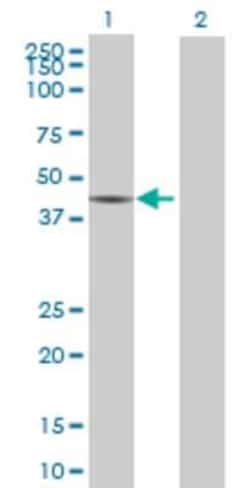 Novus Biologicals NARG2 293T Cell Transient Overexpression Lysate 0.1 mL | Buy Online | Novus Biologicals&trade; | Fisher Scientific