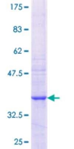 Novus Biologicals Recombinant Human GAL3ST4 GST (N-Term) Protein 25 &mu;g | Buy Online | Novus Biologicals&trade; | Fisher Scientific