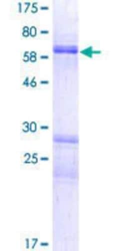 Novus Biologicals Recombinant Human MANEA GST (N-Term) Protein 10 &mu;g | Buy Online | Novus Biologicals&trade; | Fisher Scientific