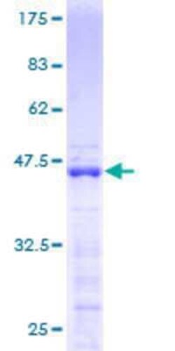 Novus Biologicals Recombinant Human ZMAT4 GST (N-Term) Protein 10 &mu;g | Buy Online | Novus Biologicals&trade; | Fisher Scientific
