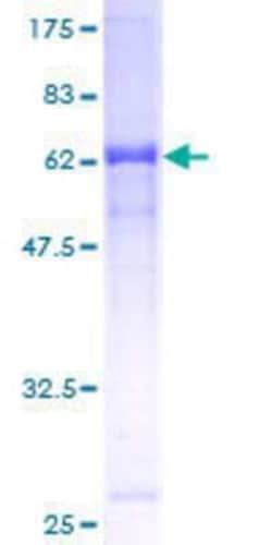 Novus Biologicals Recombinant Human ZYG11B GST (N-Term) Protein 25 &mu;g | Buy Online | Novus Biologicals&trade; | Fisher Scientific