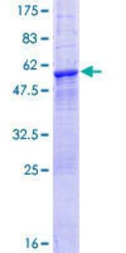 Novus Biologicals Recombinant Human LRRK1 GST (N-Term) Protein 25 &mu;g | Buy Online | Novus Biologicals&trade; | Fisher Scientific