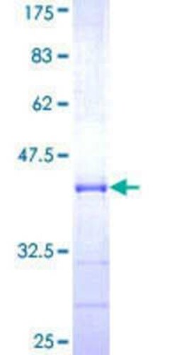 Novus Biologicals Recombinant Human TBLR1 GST (N-Term) Protein 25 &mu;g | Buy Online | Novus Biologicals&trade; | Fisher Scientific
