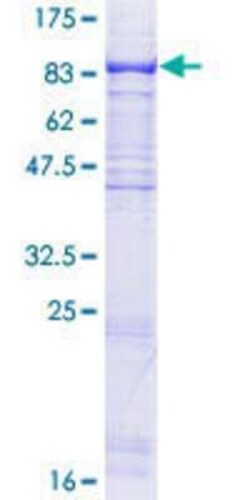 Novus Biologicals Recombinant Human WDR59 GST (N-Term) Protein 10 &mu;g | Buy Online | Novus Biologicals&trade; | Fisher Scientific