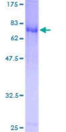 Novus Biologicals Recombinant Human E2F8 GST (N-Term) Protein 25 &mu;g | Buy Online | Novus Biologicals&trade; | Fisher Scientific