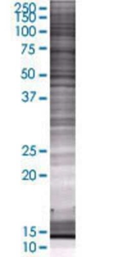 Novus Biologicals&trade;&nbsp;BBS10 293T Cell Transient Overexpression Lysate