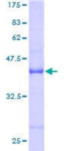 Novus Biologicals Recombinant Human Gemin 7 GST (N-Term) Protein 25 &mu;g | Buy Online | Novus Biologicals&trade; | Fisher Scientific
