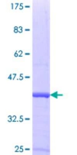 Novus Biologicals Recombinant Human Gemin 7 GST (N-Term) Protein 25 &mu;g | Buy Online | Novus Biologicals&trade; | Fisher Scientific