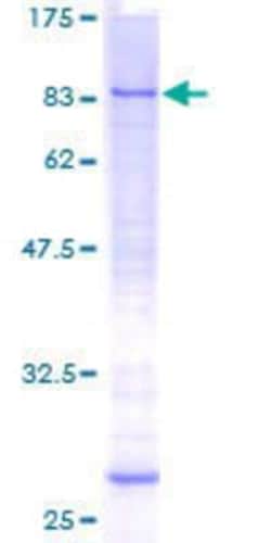 Novus Biologicals Recombinant Human MCTP1 GST (N-Term) Protein 25 &mu;g | Buy Online | Novus Biologicals&trade; | Fisher Scientific